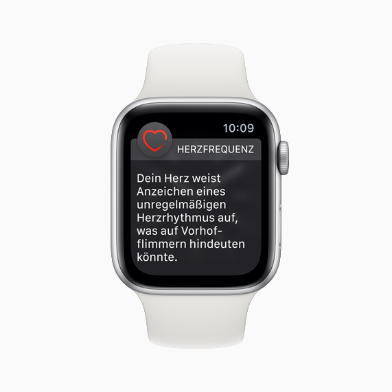 Apple Watch-Ziffernblatt mit Mitteilung über unregelmässigen Herzrhythmus.